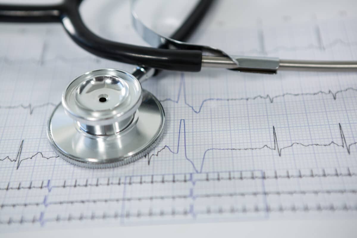 ekg readings